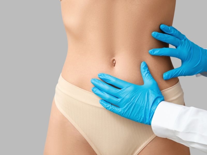 liposuction